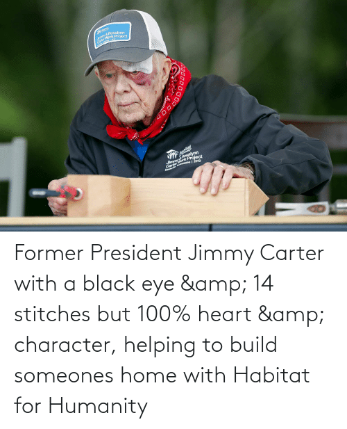former-president-jimmy-carter-with-a-black-eye-amp-14-67872382